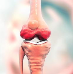 Ligamentos